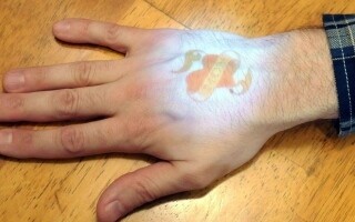 Австрийский бизнесмен вживляет микрочипы в свое тело для замены ключей и кредитных карт