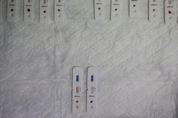 Исследование показывает долгосрочное ослабление иммунной системы после заражения COVID-19